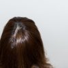 ２０代の男女に白髪が発生する原因とは？５つの予防法で増加を食い止めよう！